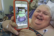 Etats-Unis / Sa tumeur faisait 60kg «On m'a dit: c’est du gras»